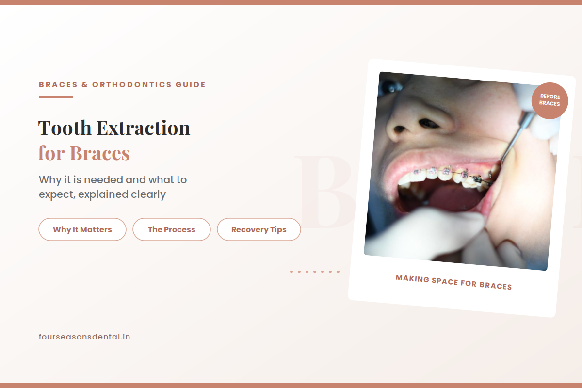 Illustration explaining tooth extraction for braces and orthodontic space creation