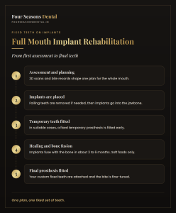 Full mouth implant rehabilitation stages from assessment and implant placement to healing and final fixed prosthesis