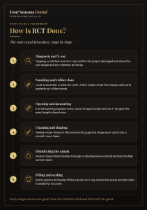 Infographic showing how is RCT done, with the stages of what happens in RCT from diagnosis and numbing to cleaning, disinfecting and filling the root canals