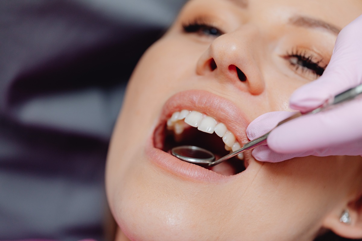 Full Mouth Rehabilitation at Four Seasons Dental Surat