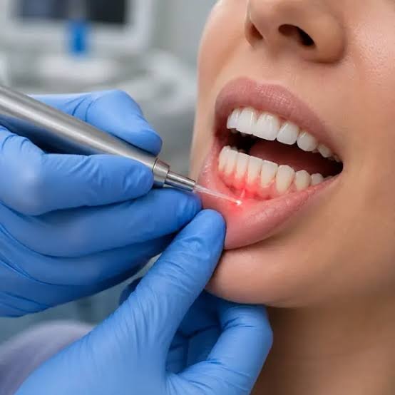 Laser Dentistry