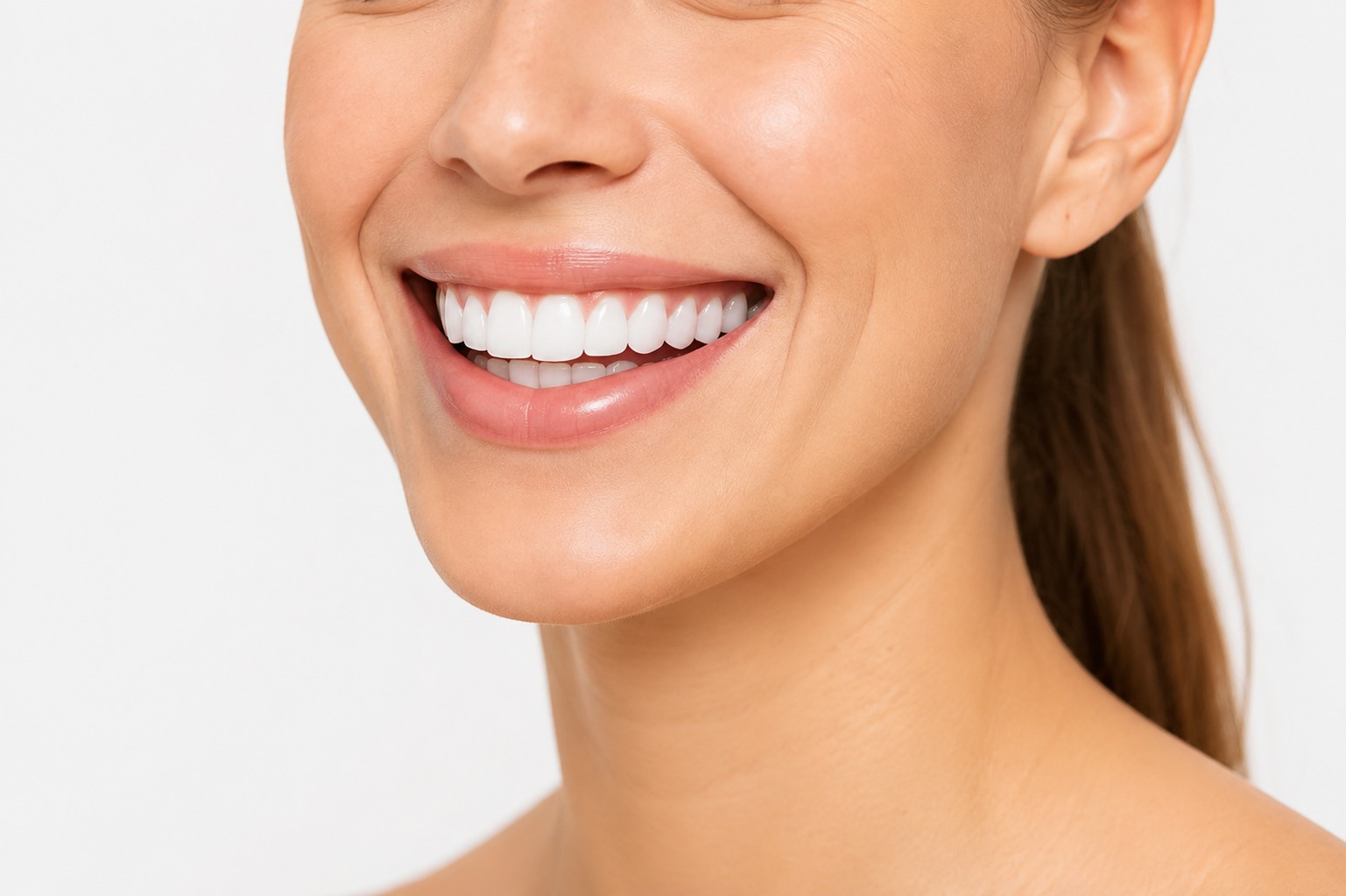 What is Smile Makeover